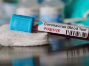 Coronavirus: 208 nouveaux cas, 133 guérisons et 7 décès